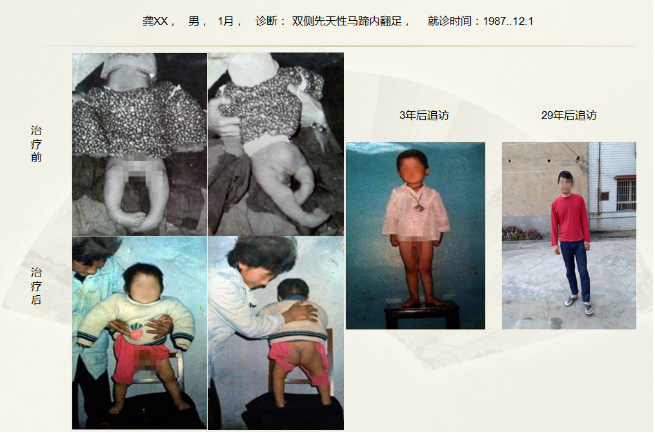 病例二