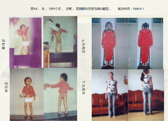 病例四