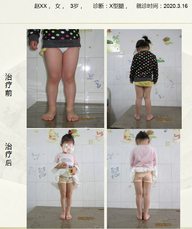 病例十八