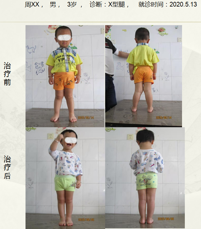 病例十七