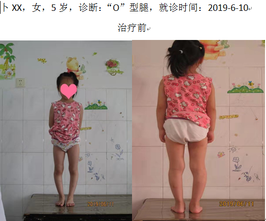 病例十九