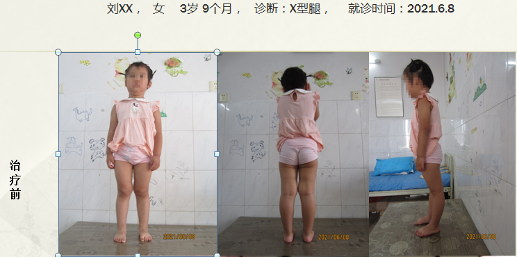 病例二十四