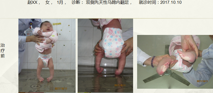 病例二十七