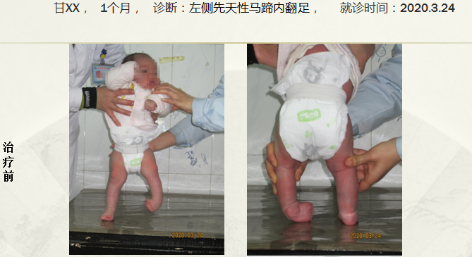 病例二十五