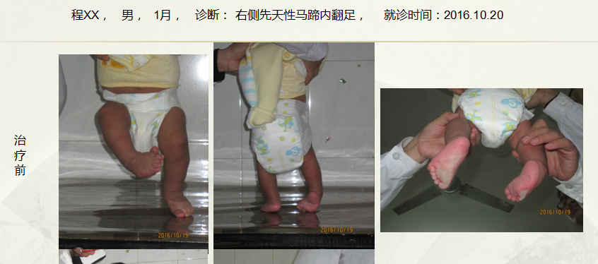 病例二十六