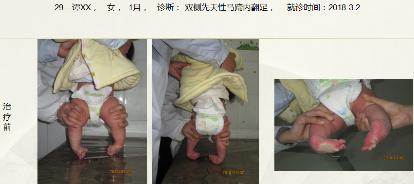 病例二十九
