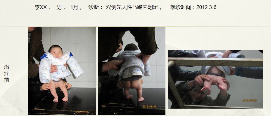 病例三十