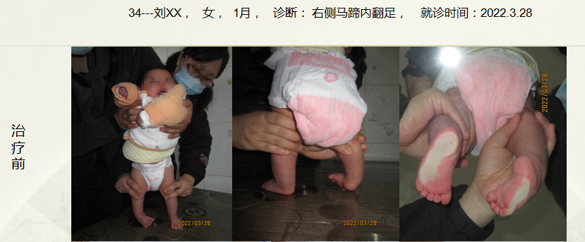 病例三十四