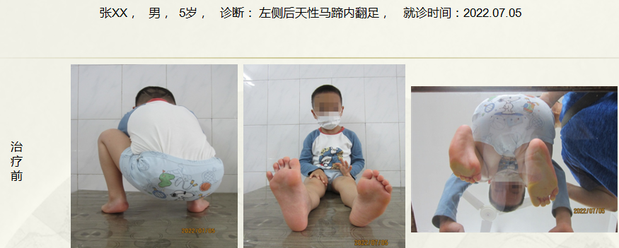 病例三十七