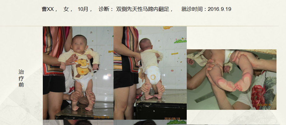 病例三十八