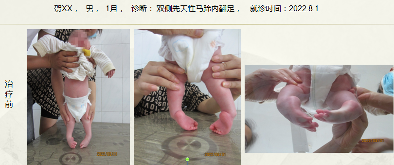 病例三十九