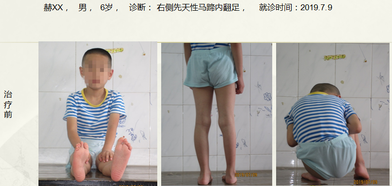 病例四十