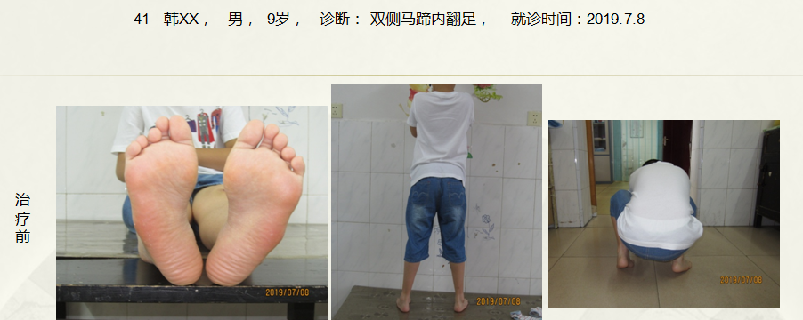 病例四十一
