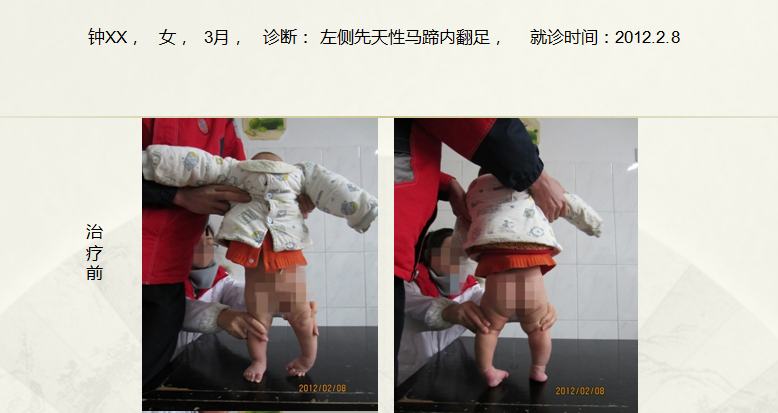 病例四十二