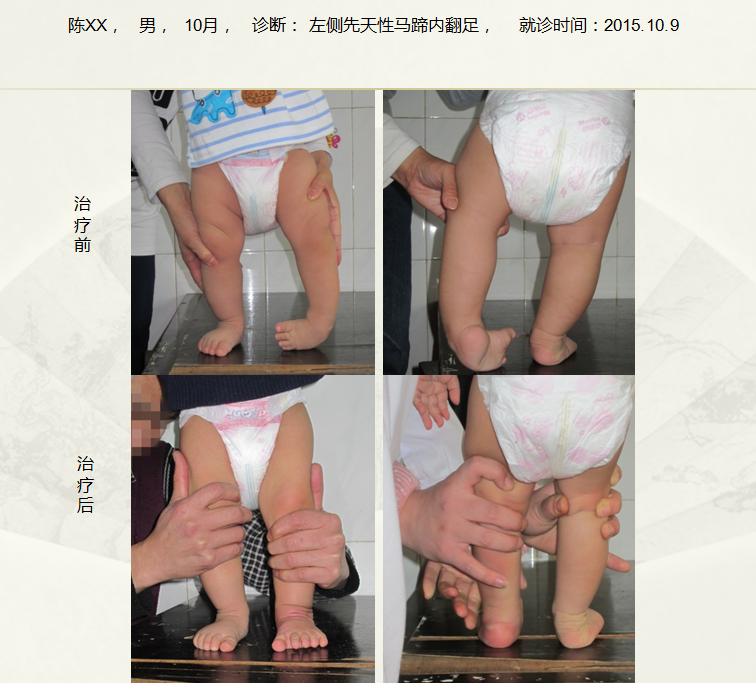 QQ截图20230317092450.png