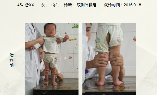 四十五