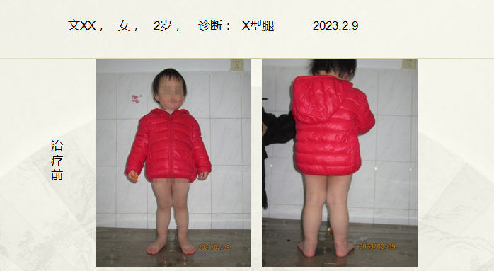 病例四十六