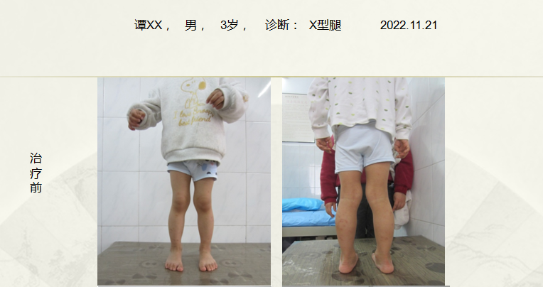 病例四十七
