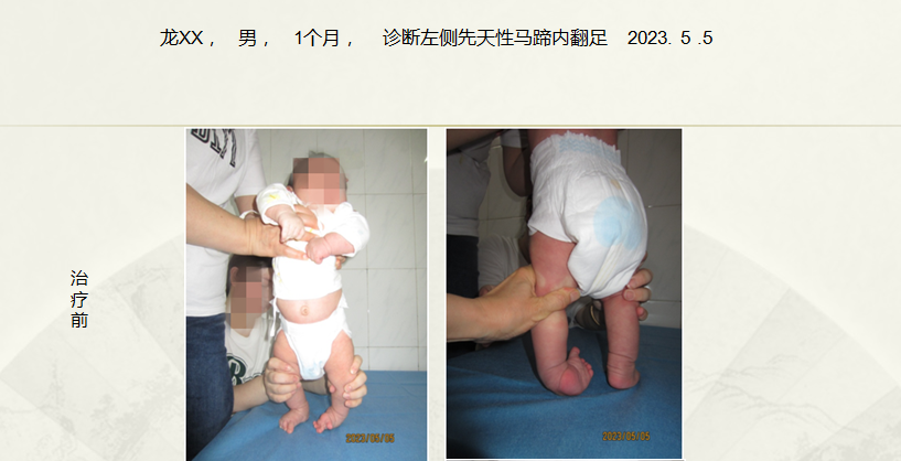 病例四十八