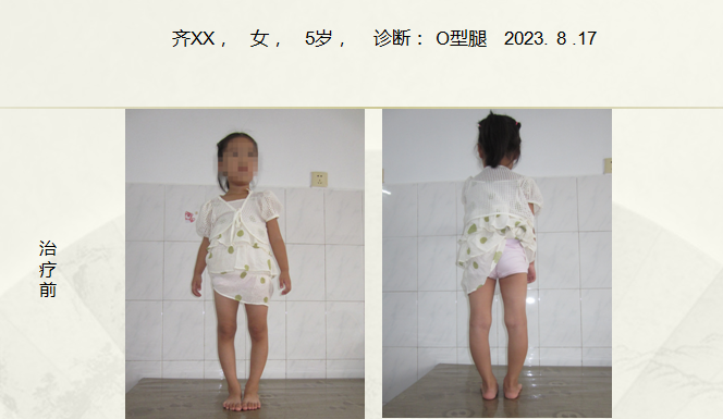 病例五十