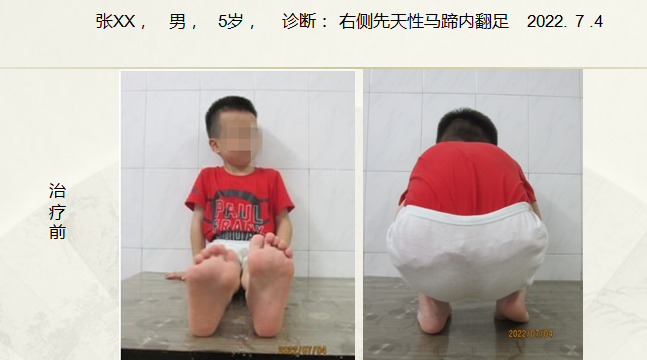 病例五十一