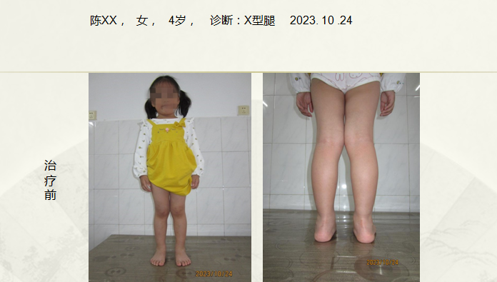 病例五十四