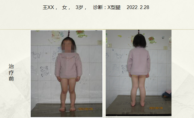 病例五十五