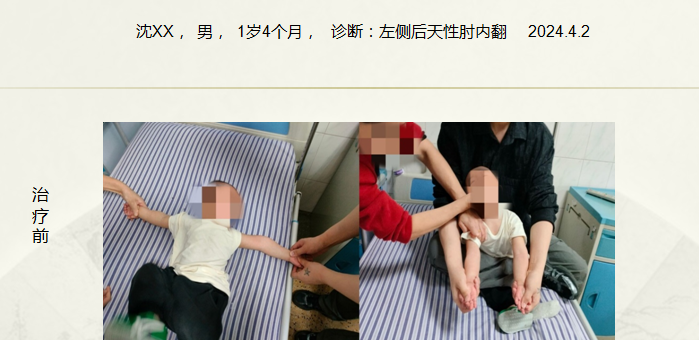 病例五十七