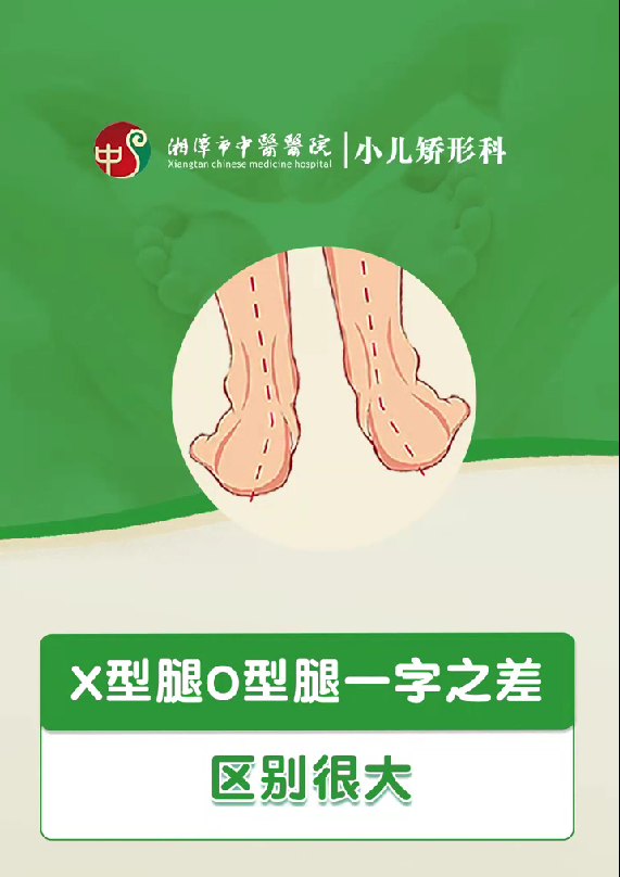 小儿矫形科能治什么？