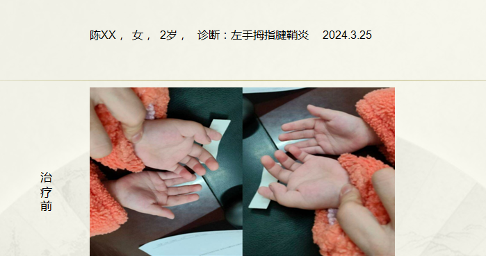 病例五十八
