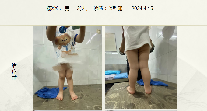 病例五十九