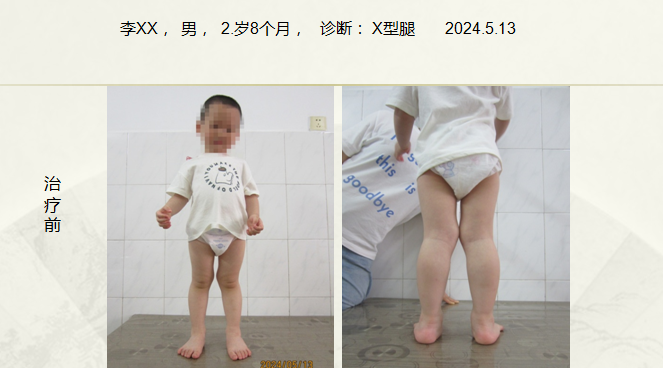病例六十