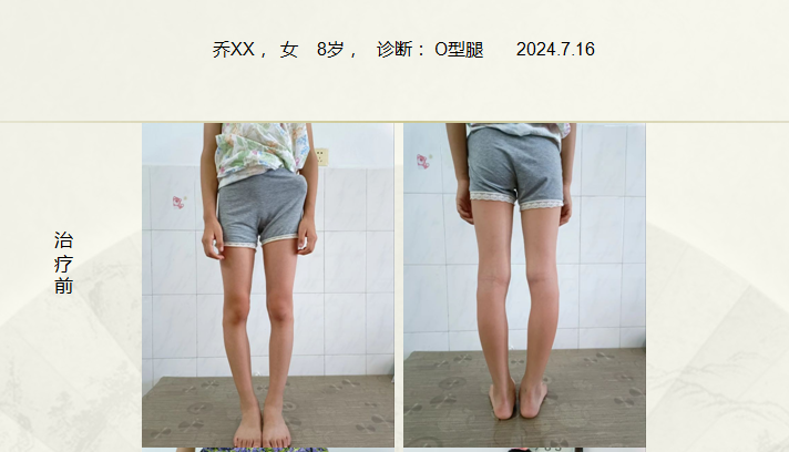 病例六十一