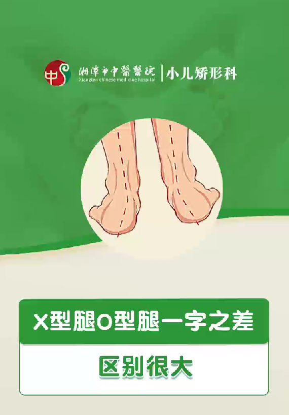 X型腿O型腿一字之差，区别很大