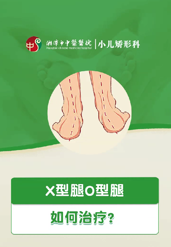X型腿O型腿如何治疗