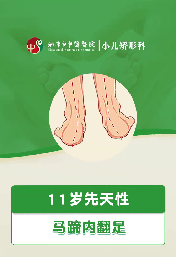 11岁先天性马蹄内翻足
