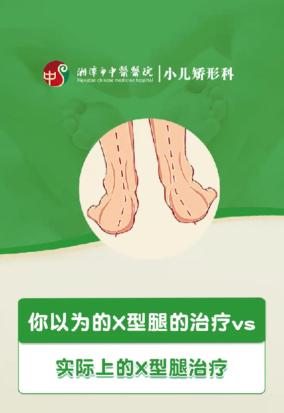 你以为的X型腿的治疗VS实际上X型腿的治疗