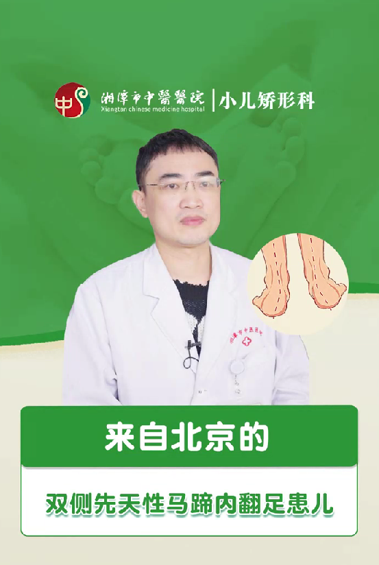 来自北京的双侧先天性马蹄内翻足患儿