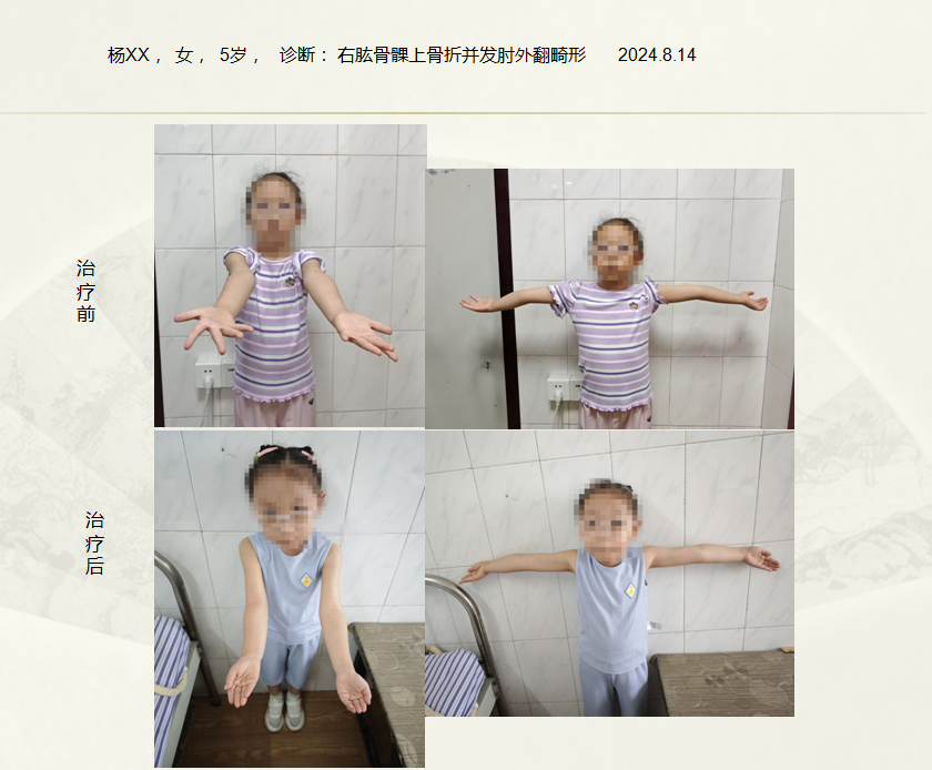 QQ20241029-174637.png