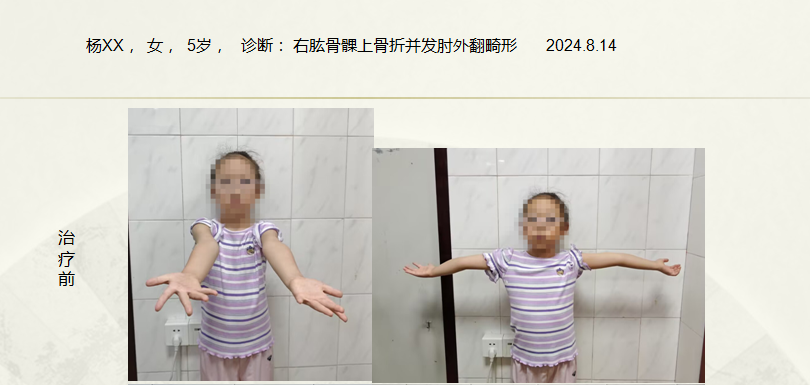 病例六十二