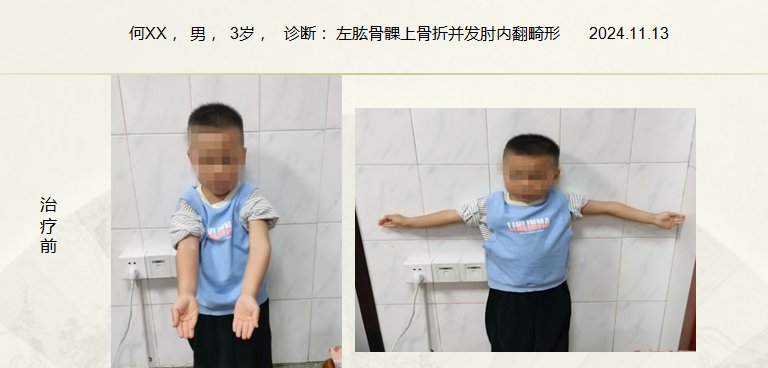 病例六十三