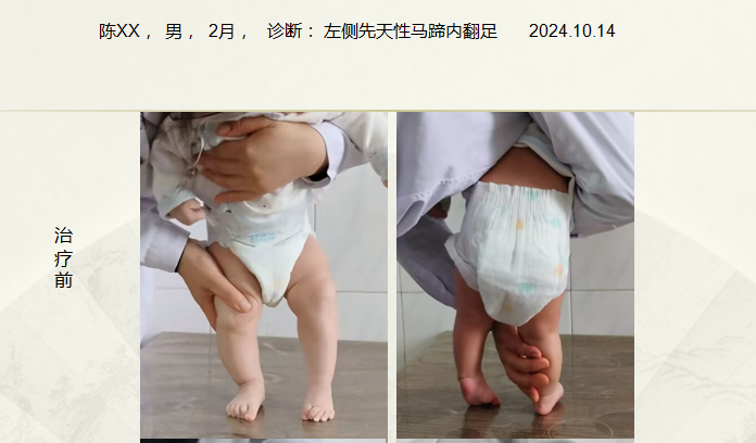 病例六十四