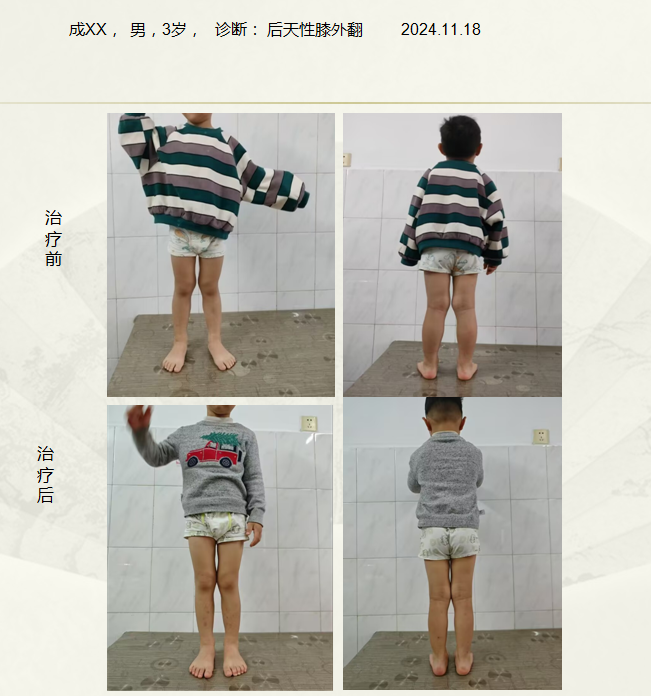 QQ20250126-173829.png