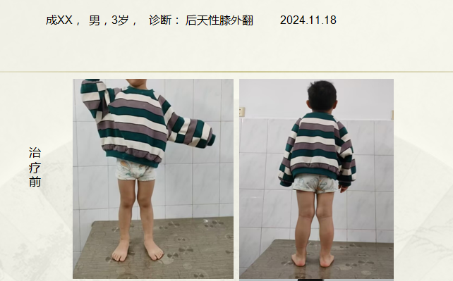 病例六十五