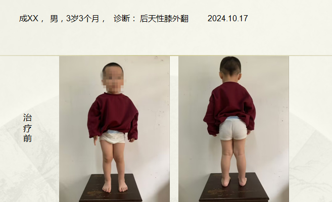 病例六十六