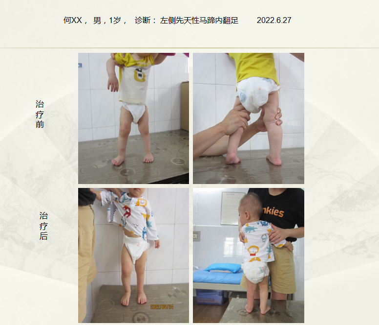 QQ20250403-172812.png