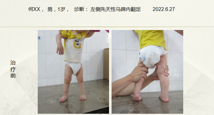 病例六十七