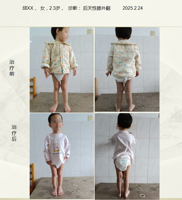 QQ20250427-172139.png