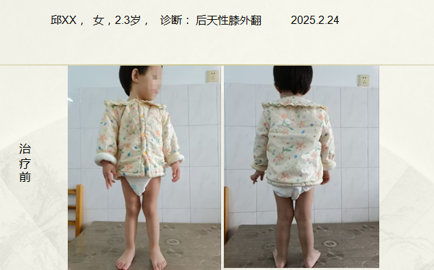 病例六十八