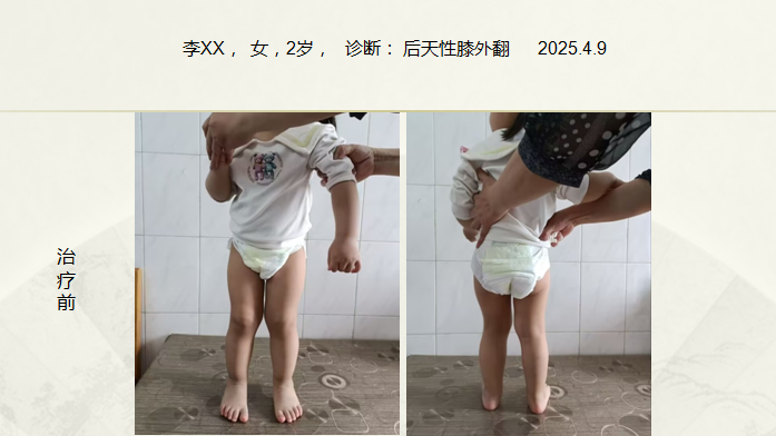病例七十三